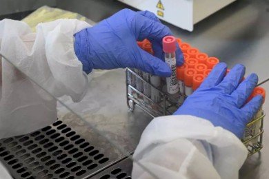 Covid: Minas vai receber 1,5 milhão de testes rápidos na próxima semana
