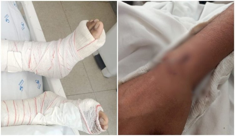 Mulher pula de prédio para fugir do marido que tentava esfaqueá-la: 'não queria ser mais um número'